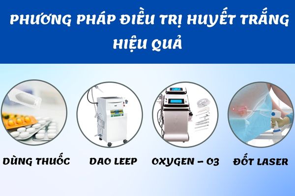 Các phương pháp điều trị các bệnh lý huyết trắng phổ biến