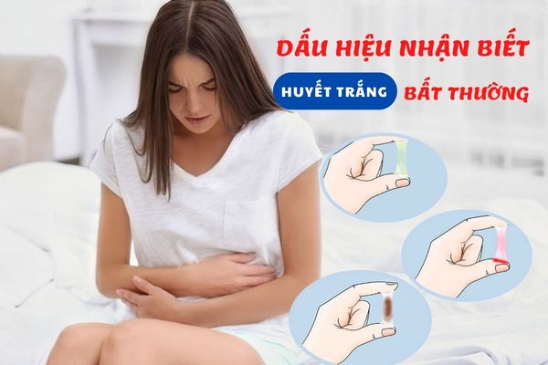 Dấu hiệu huyết trắng bất thường – Cảnh báo bệnh lý phụ khoa nữ giới