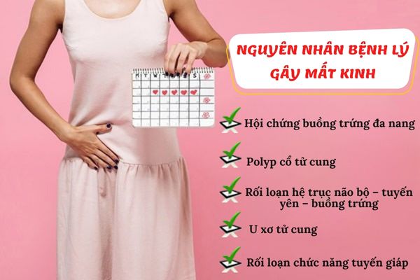 Nguyên nhân bệnh lý gây mất kinh ở nữ giới