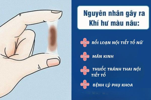 Nguyên nhân khiến vùng kín ra dịch nâu