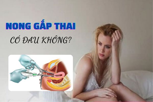 Nong gắp thai có đau không? Quy trình thực hiện an toàn, hiệu quả nhất