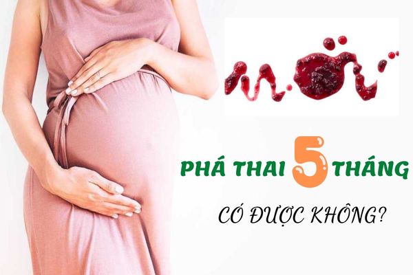 Phá thai 5 tháng tuổi có an toàn không? Phương pháp phá thai hiệu quả