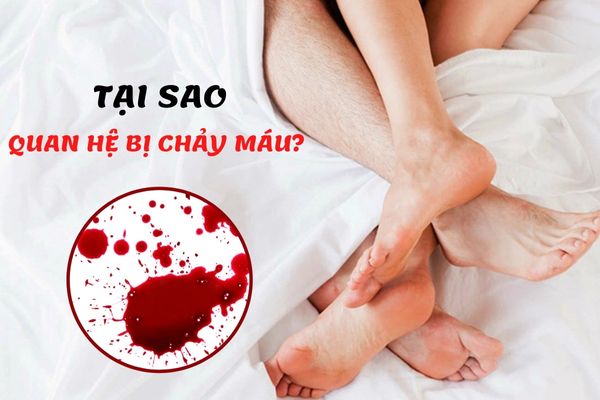 Quan hệ bị chảy máu – Nguyên nhân và cách điều trị hiệu quả nhất