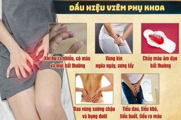 Viêm phụ khoa biểu hiện qua nhiều triệu chứng khác nhau