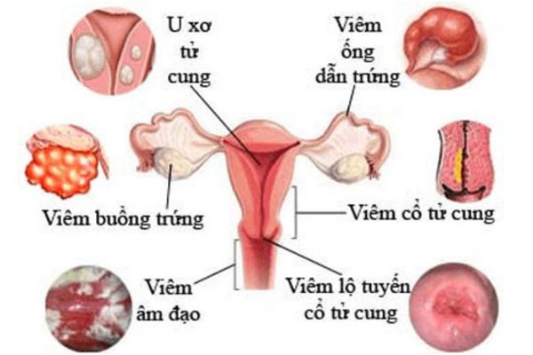 Các bệnh lý về tử cung nữ giới cần phải đặc biệt lưu ý