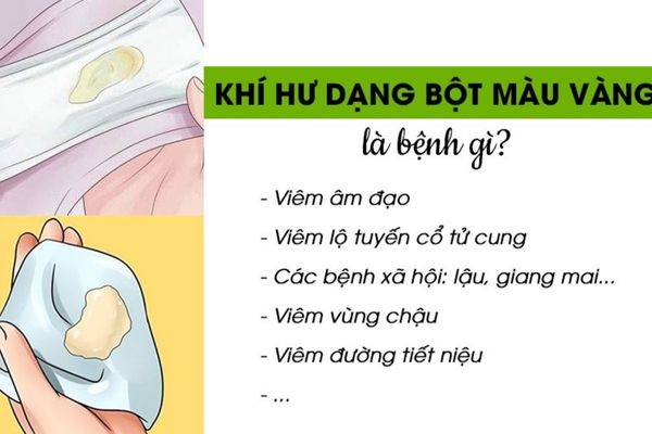 Khí hư màu vàng là dấu hiệu bất thường đáng lưu ý