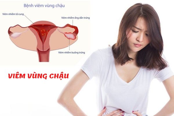 Quan hệ đau rát do viêm vùng chậu gây ra