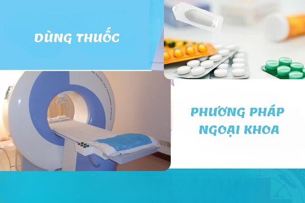 Phương pháp điều trị quan hệ đau uy tín, hiệu quả