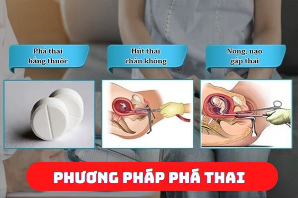 Các phương pháp phá thai được áp dụng phổ biến