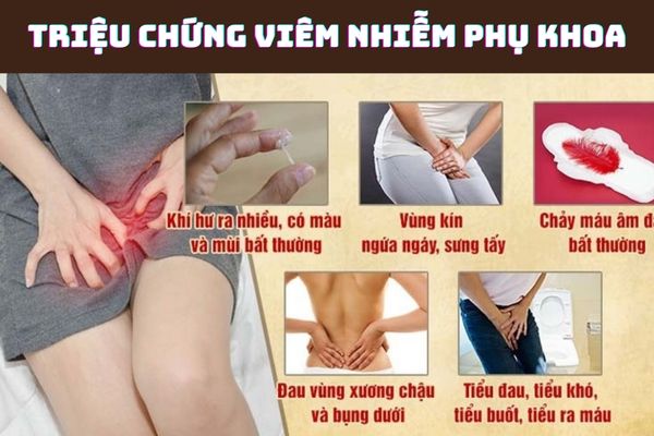 Các triệu chứng phổ biến của bệnh viêm nhiễm phụ khoa