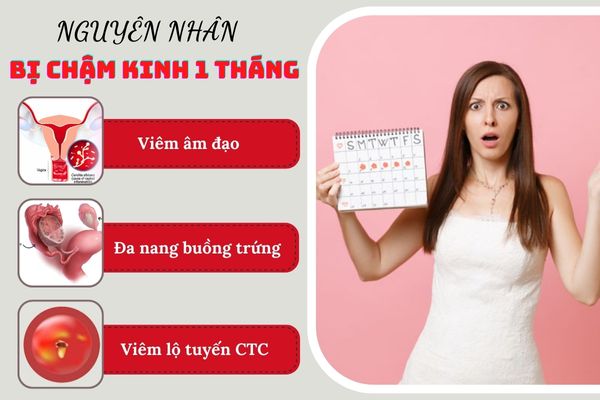 Chậm kinh 1 tháng là dấu hiệu cảnh báo bệnh lý nguy hiểm