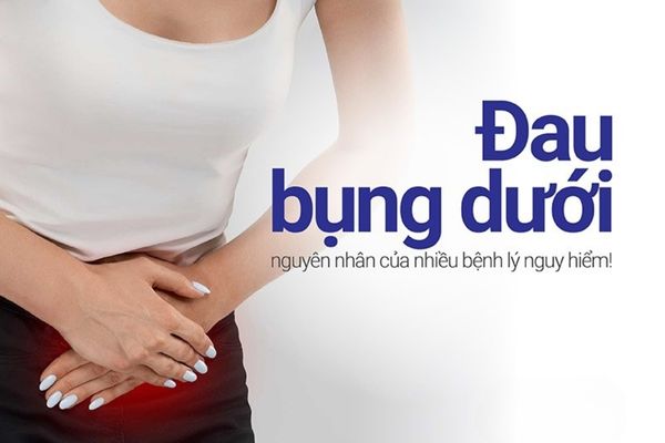 [Giải đáp thắc mắc] Đau bụng dưới là bị gì? Cách điều trị hiệu quả