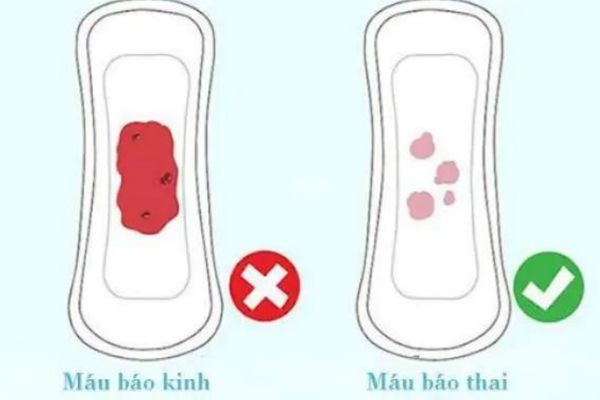 Phân biệt máu báo thai và máu kinh nguyệt