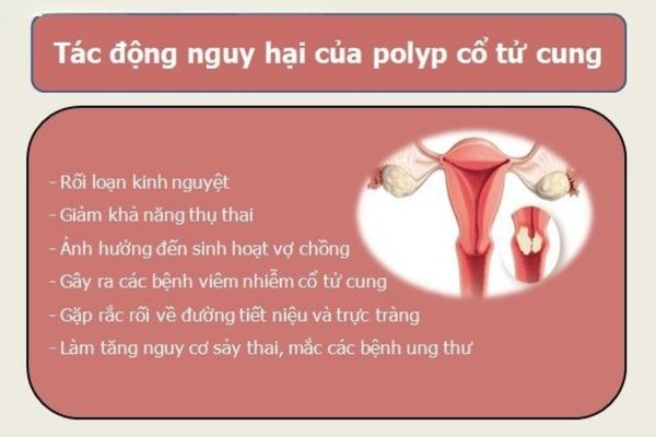 Polyp cổ tử cung gây ảnh hưởng đến sức khỏe của người bệnh