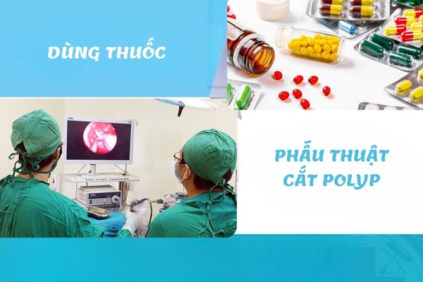 Phương pháp điều trị Polyp cổ tử cung hiệu quả