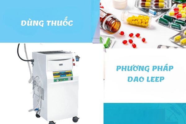 Các phương pháp điều trị quan hệ đau bụng ở nữ giới