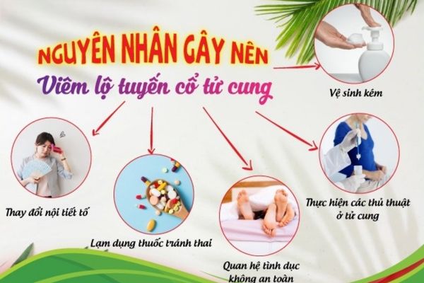 Nguyên nhân gây bệnh viêm lộ tuyến cổ tử cung thường gặp