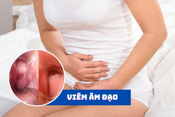 Viêm âm đạo gây đau rát vùng kín ở nữ giới