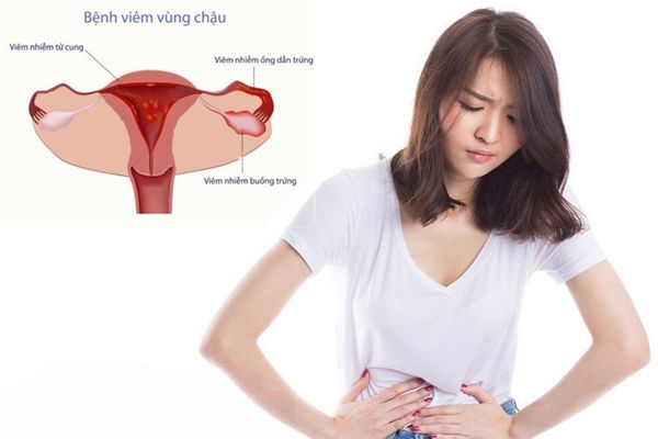 Âm đạo bị đau do viêm vùng chậu gây ra