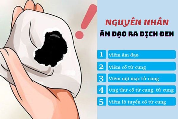 Âm đạo ra dịch đen do nhiều nguyên nhân bệnh lý gây ra