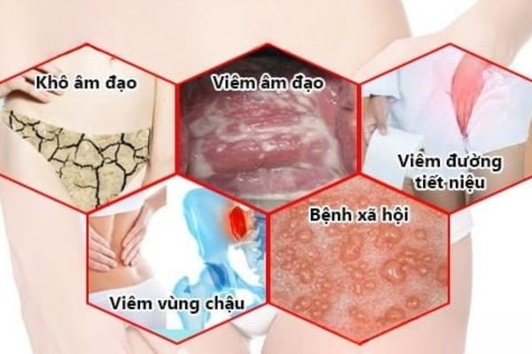 Đau rát âm đạo do nhiều nguyên nhân khác nhau gây ra