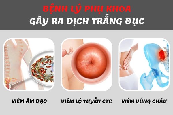 Ra dịch màu trắng đục cảnh báo nhiều bệnh lý nguy hiểm